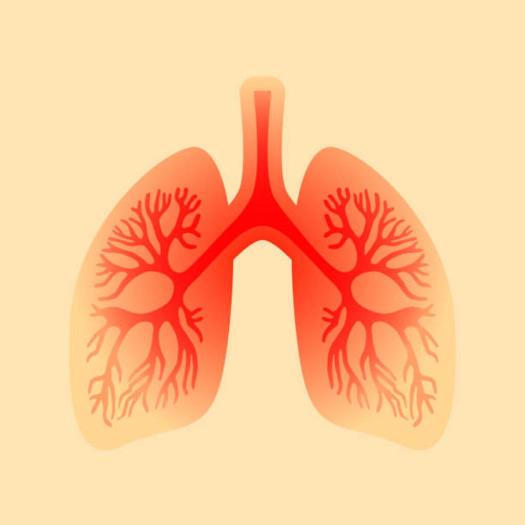 pleurisy