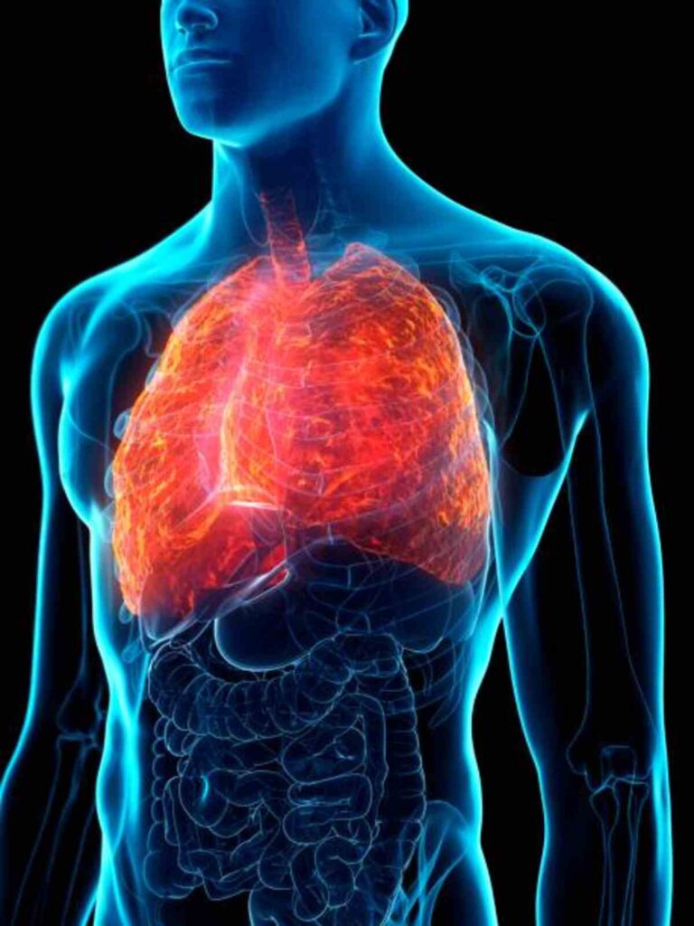 bronchitis symptoms