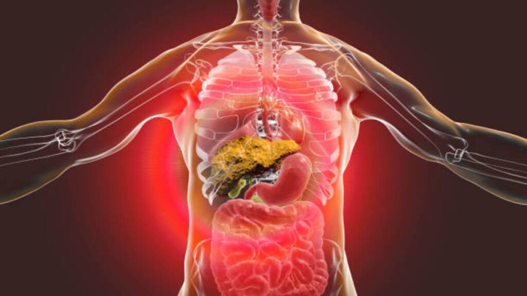 cirrhosis of the liver