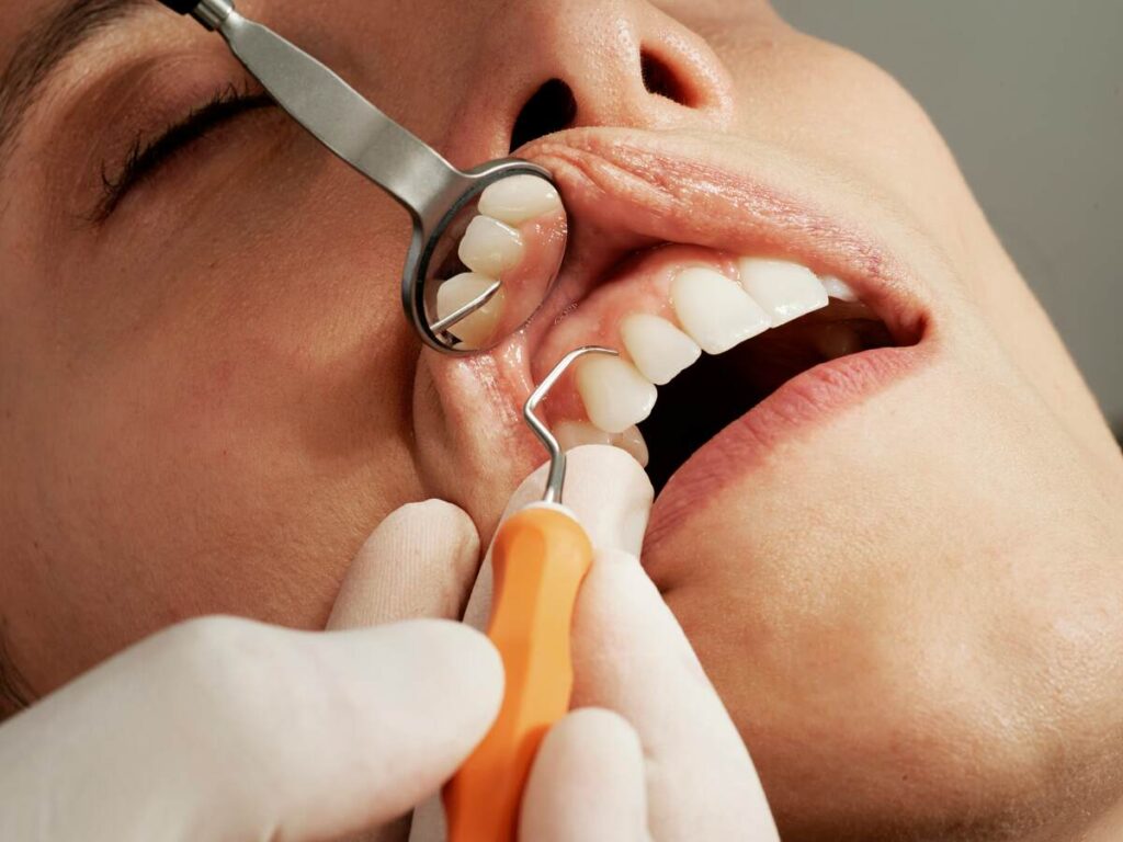 Revealing the Secrets of Dental Insurance Business